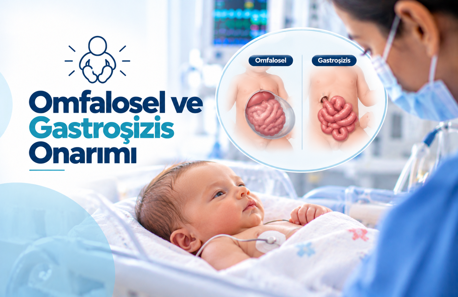 Bebeklerde Omfalosel ve Gastroşizis Nedir?