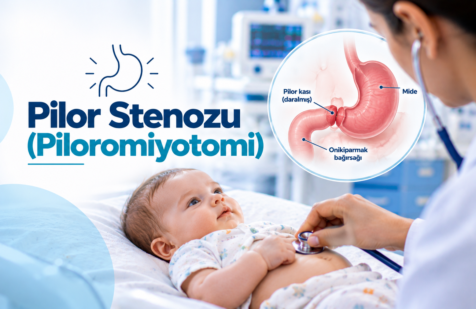 Bebeklerde Pilor Stenozu Nedir?