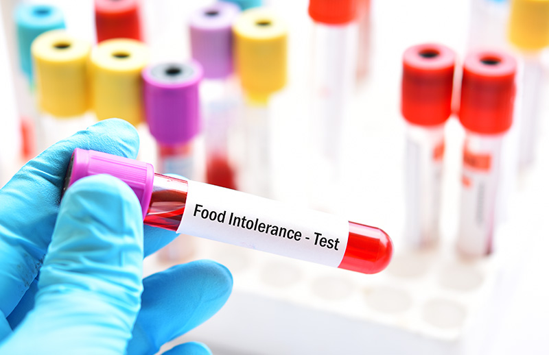 Besin İntoleransı Testi Nedir?
