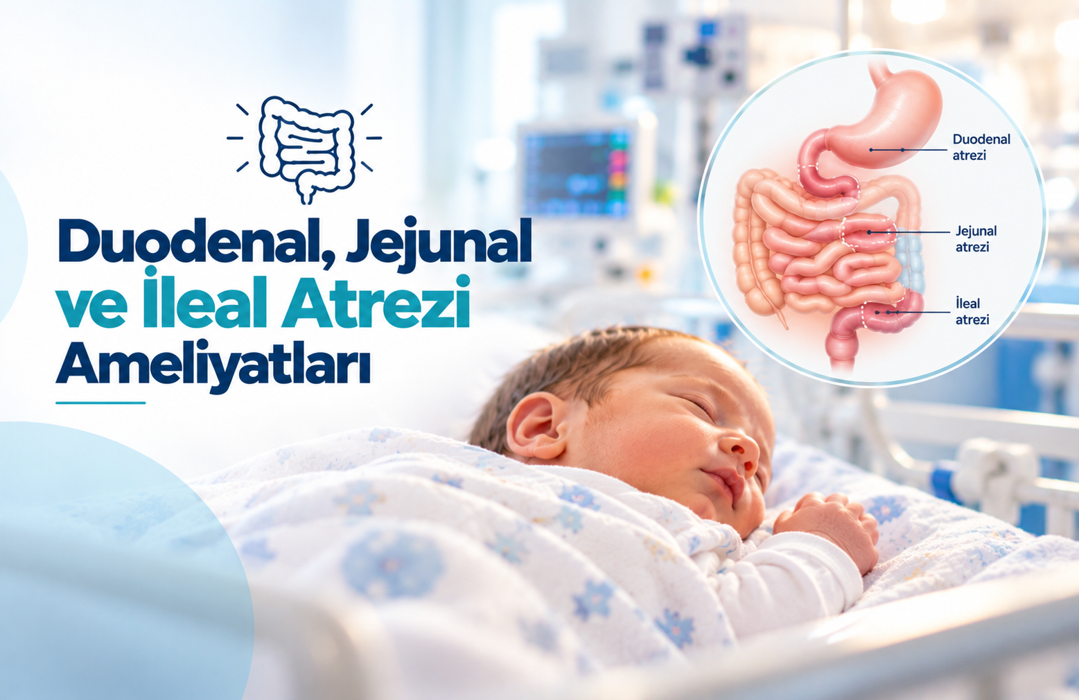 Yenidoğanlarda Bağırsak Atrezisi Ameliyatları
