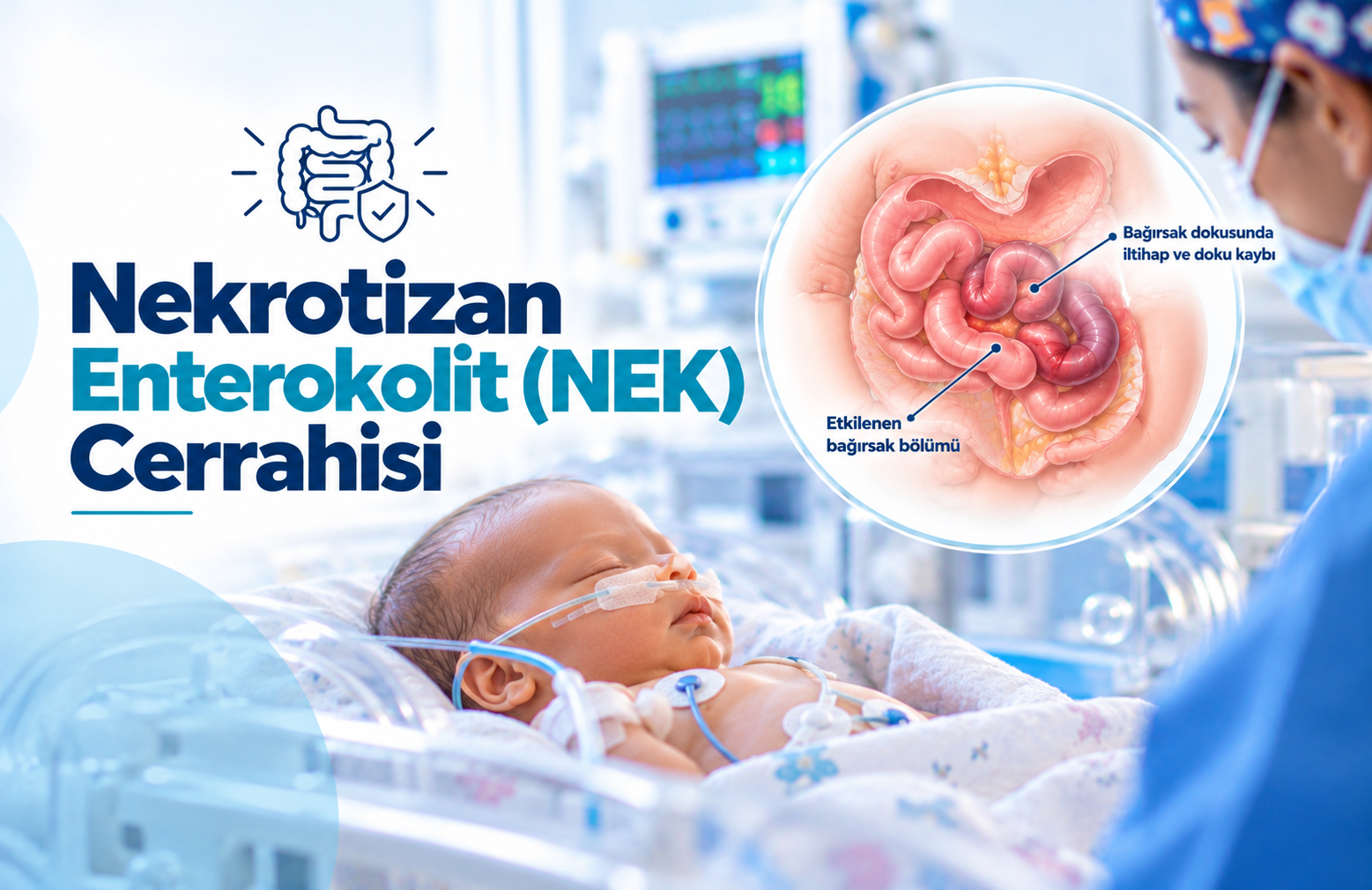 Yenidoğanlarda Nekrotizan Enterokolit (NEK) Nedir?